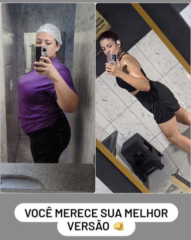 Antes e depois de aluna do Método Queima Extrema