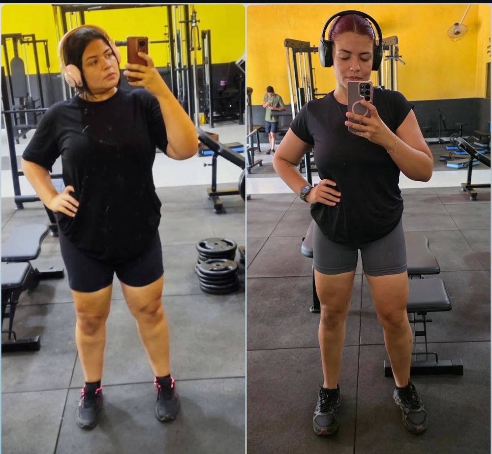 Antes e depois de aluna do Método Queima Extrema